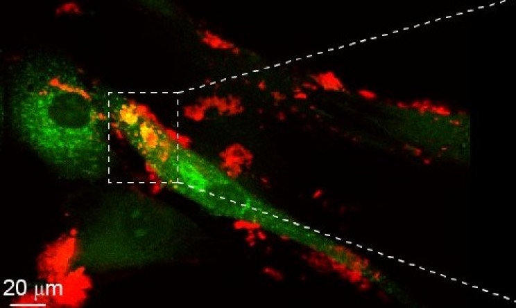 Researchers Use Clay Nanoparticles to Transform Stem Cells Into Bone and Cartilage