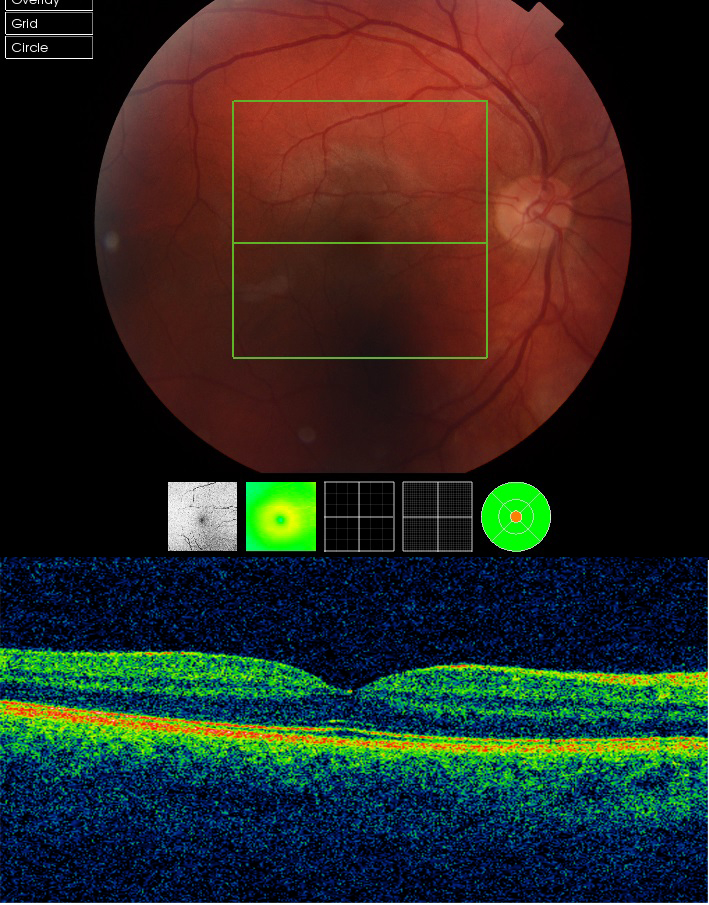 AI System by Google’s DeepMind Can Diagnose Over 50 Common Eye Diseases AI System by Google’s DeepMind Can Diagnose Over 50 Common Eye Diseases