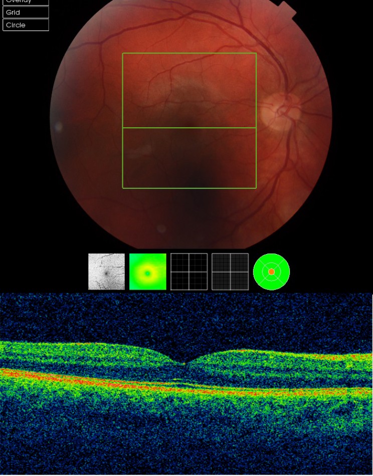 AI System by Google’s DeepMind Can Diagnose Over 50 Common Eye Diseases AI System by Google’s DeepMind Can Diagnose Over 50 Common Eye Diseases