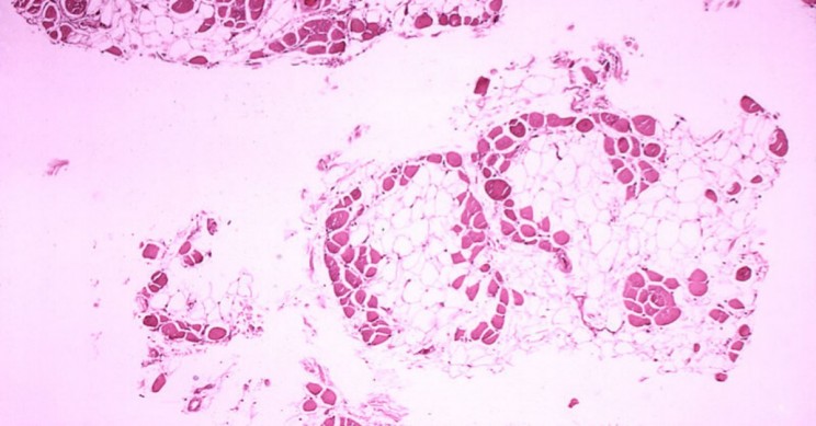 CRISPR Stops Muscular Dystrophy in Dogs Giving Humans Hope