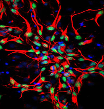Scientists Use Big Data to Awaken Stem Cells and Heal Brain Tissue Scientists Use Big Data to Awaken Stem Cells and Heal Brain Tissue