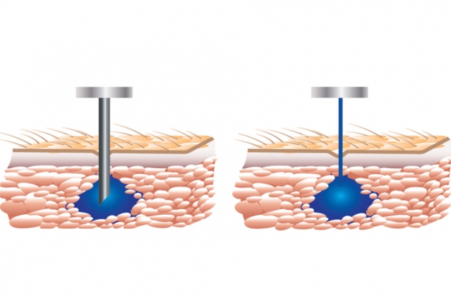This Needle-Free Injector is About to Replace Traditional Shots This Needle-Free Injector is About to Replace Traditional Shots