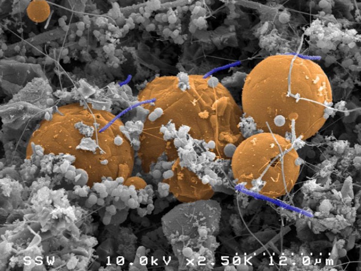 Underground Ecosystem More Diverse Than Life on The Surface Underground Ecosystem More Diverse Than Life on The Surface