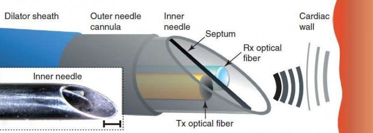 New Surgical Needle Can Send Real-Time Ultrasound Images to Surgeons