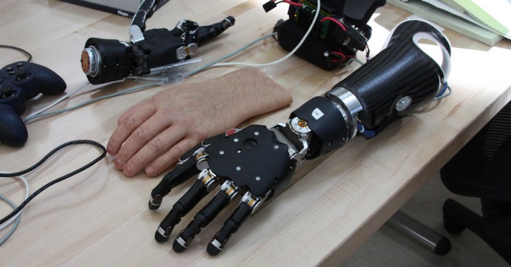 brain prosthetic
