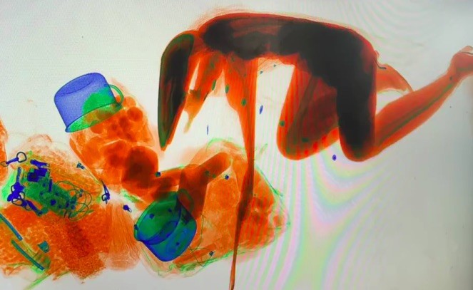 Woman in China Crawls Into X-Ray Machine to Accompany Her Handbag Woman in China Crawls Into X-Ray Machine to Accompany Her Handbag