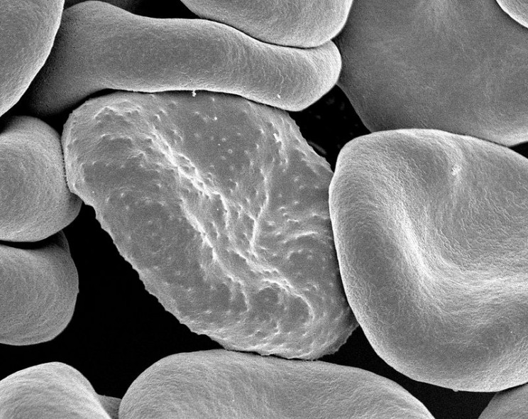 New Technology Helps Researchers Fight Deadly Malaria