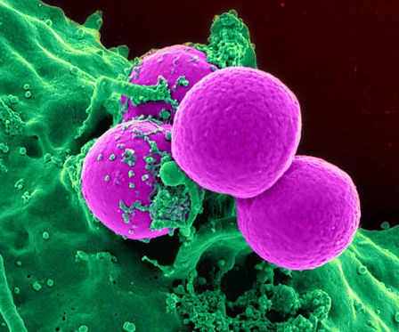Gene-Editing Tool CRISPR Could Help Doctors Kill Cancer Cells