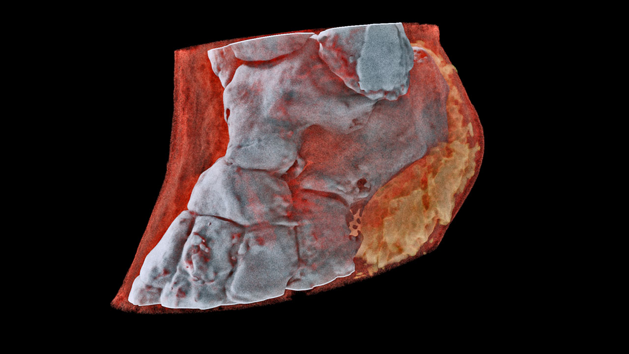 World's First 3D Color X-Rays of Human Body Produced Using CERN Technology World's First 3D Color X-Rays of Human Body Produced Using CERN Technology