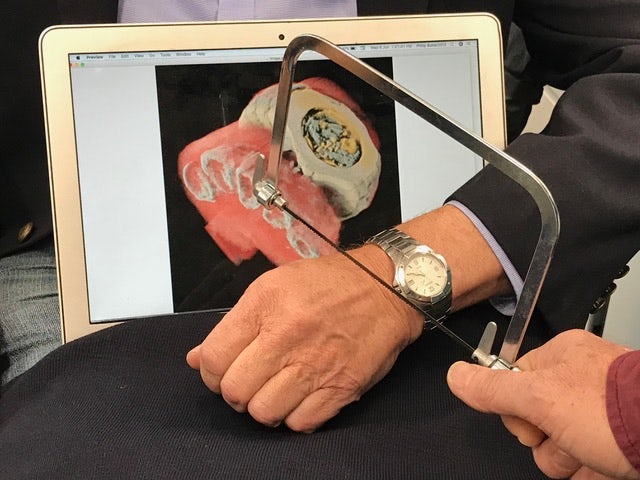 World's First 3D Color X-Rays of Human Body Produced Using CERN Technology World's First 3D Color X-Rays of Human Body Produced Using CERN Technology