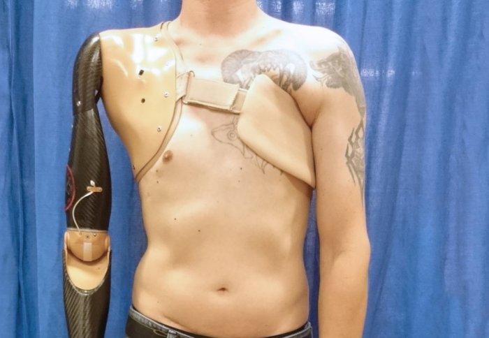 Robotic Prosthetics