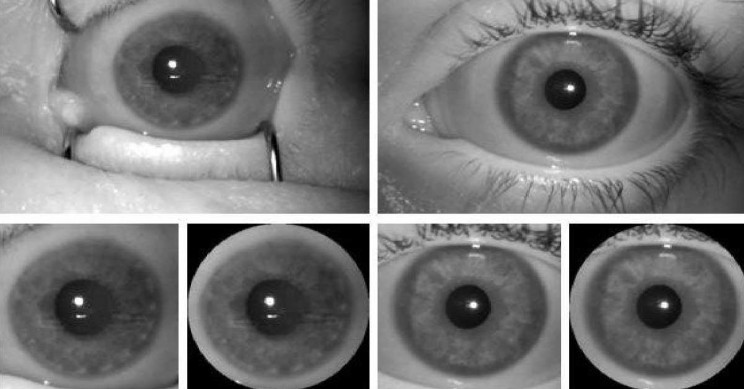 AI Scanner Can Differentiate Between Live Irises and Dead Ones