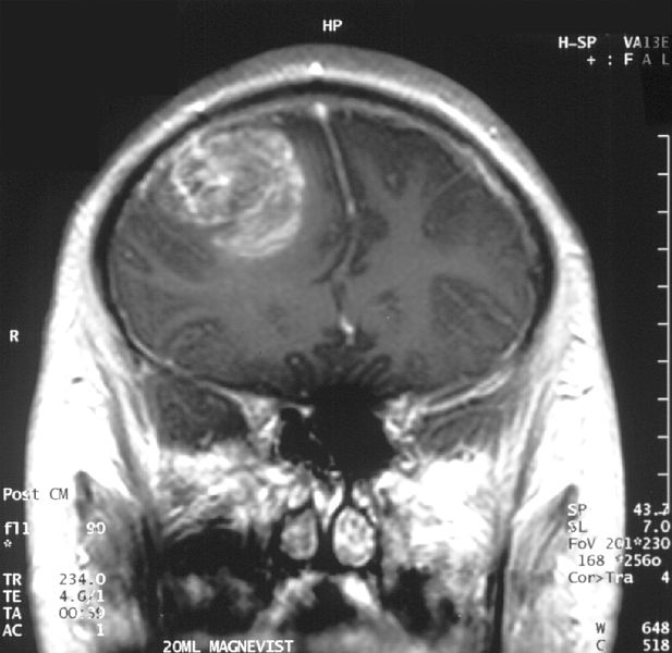 11 Interesting Discoveries of the Brain Over the Past Ten Years 11 Interesting Discoveries of the Brain Over the Past Ten Years