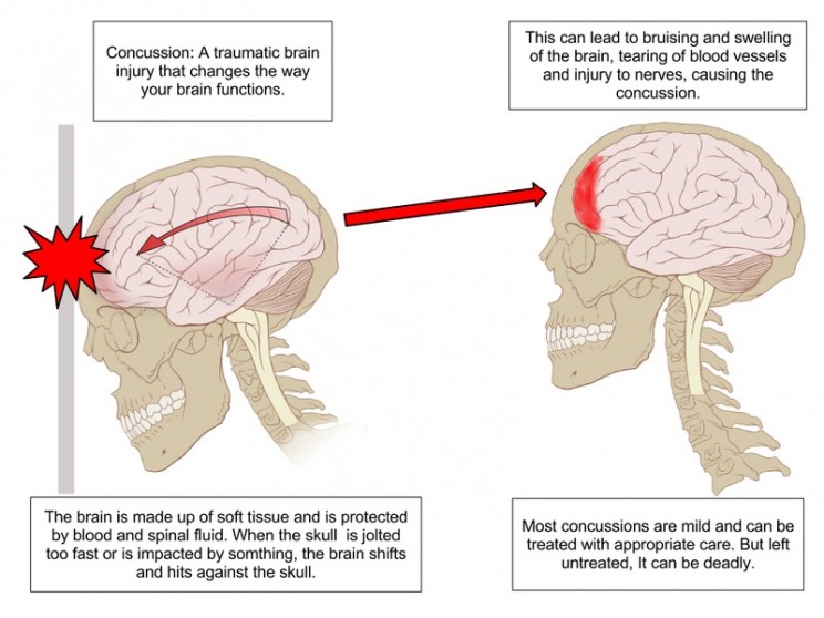 11 Interesting Discoveries of the Brain Over the Past Ten Years 11 Interesting Discoveries of the Brain Over the Past Ten Years