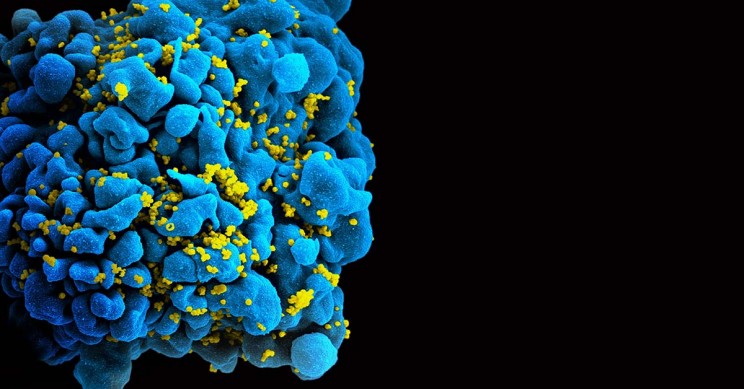 HIV-Infected-T-Cell HIV Infected T Cell
