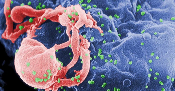 HIV-T-Cell HIV T Cell