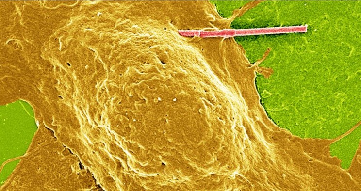 Researchers Invent Way to 'Hack' Into the Brain's Electrical Signals
