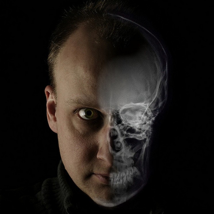 myths about x-rays radioactive