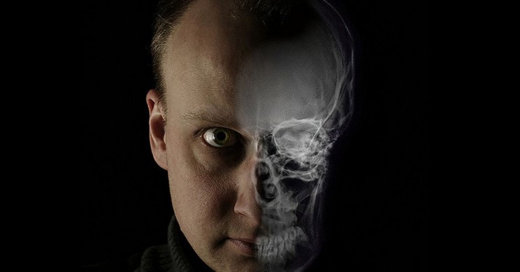 5 Myths About X-rays and Why We Need Them
