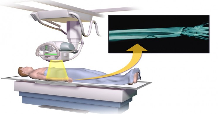 Everything You Need to Know About the X-Ray and Its Accidental History