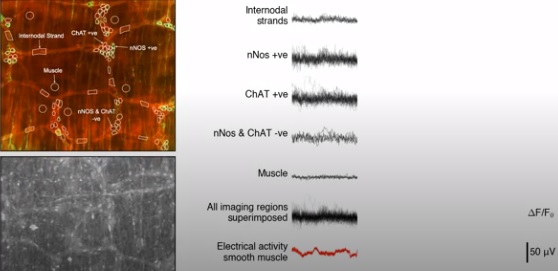'Second Brain' Neurons Located in the Gut Observed For the First Time 'Second Brain' Neurons Located in the Gut Observed For the First Time