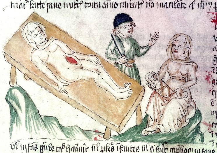 13 Medical Practices of the Renaissance That Are Still Used Today 13 Medical Practices of the Renaissance That Are Still Used Today