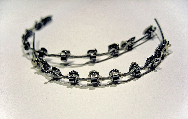 NASA Spinoffs Invisible Braces