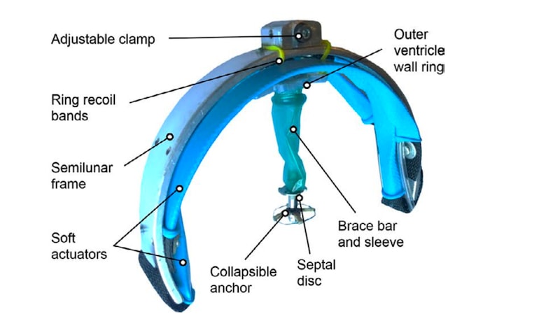 This Soft Robot Saves Failing Hearts By Mimicking Cardiac Muscle This Soft Robot Saves Failing Hearts By Mimicking Cardiac Muscle