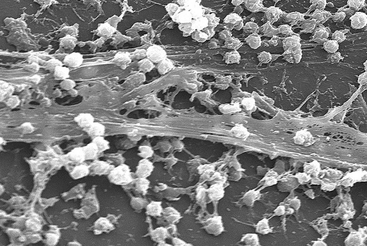Scientists Have Developed Electrically Charged Bandages to Fight Infections