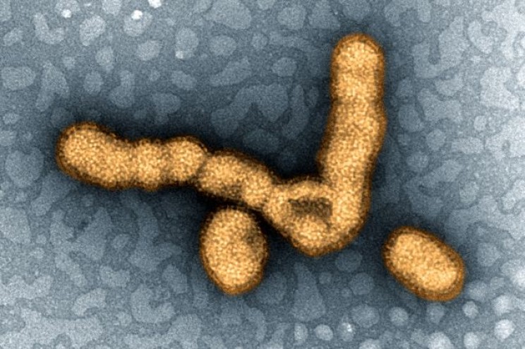 Influenza Virus Particles