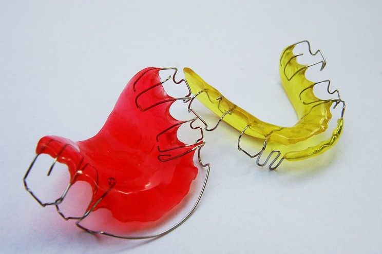 Orthodontists Say Braces Should be Worn for Life to Keep Teeth Straight Orthodontists Say Braces Should be Worn for Life to Keep Teeth Straight