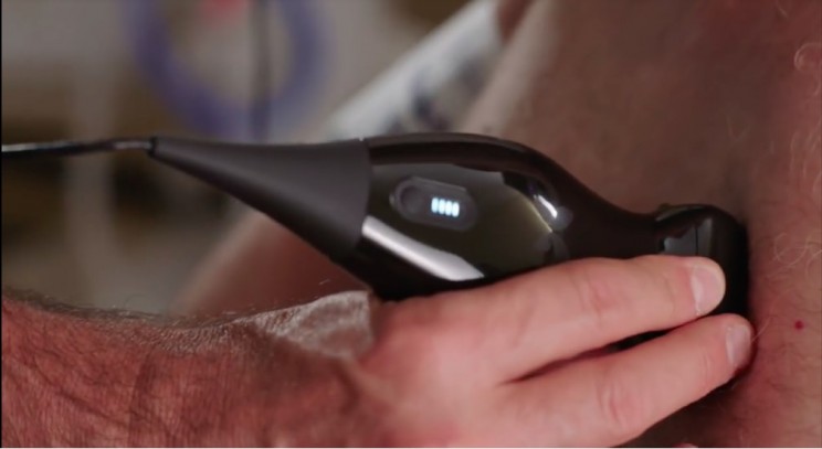 This Affordable iPhone Ultrasound Machine Helped a Doctor Spot His Own Cancer This Affordable iPhone Ultrasound Machine Helped a Doctor Spot His Own Cancer