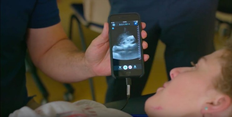 This Affordable iPhone Ultrasound Machine Helped a Doctor Spot His Own Cancer This Affordable iPhone Ultrasound Machine Helped a Doctor Spot His Own Cancer