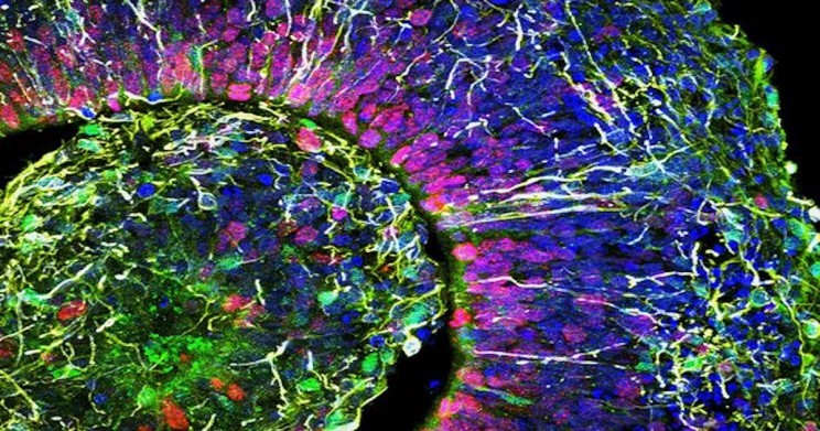 Scientists Develop Fast Cheap Method For Growing 'Brains-in-a-Dish'