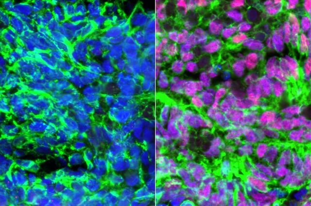 11 of the Most Exciting Stem Cell Research and Studies Set to Revolutionize Healthcare 11 of the Most Exciting Stem Cell Research and Studies Set to Revolutionize Healthcare