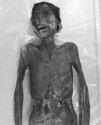 Incredible 375-Year-Old Mummy and his Ancient Parasite Discovered in South Korea Incredible 375-Year-Old Mummy and his Ancient Parasite Discovered in South Korea