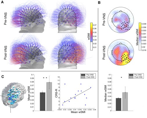 35-Year-Old Man in Vegetative State Regains Consciousness After 15 Years 35-Year-Old Man in Vegetative State Regains Consciousness After 15 Years
