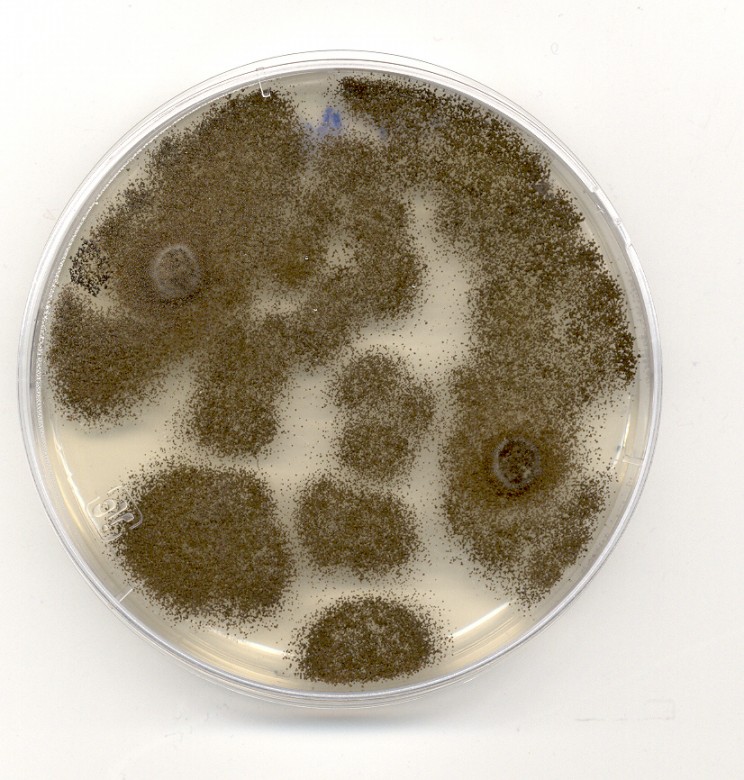 Scientists Have Found A Fungus That Feasts On Plastic Scientists Have Found A Fungus That Feasts On Plastic