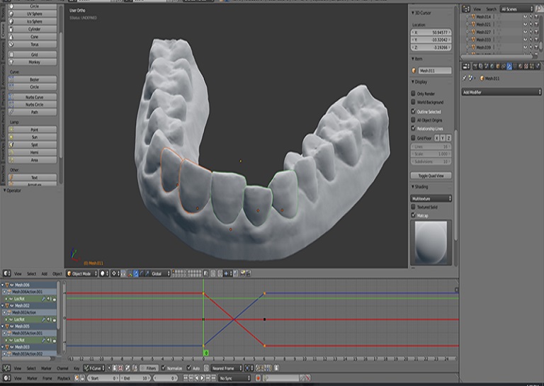 designing a 3D printed retainer