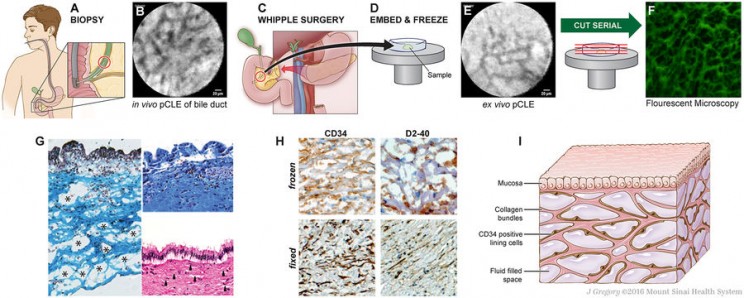 Scientists Discover a New Human Organ Called the 'Interstitium' Scientists Discover a New Human Organ Called the 'Interstitium'