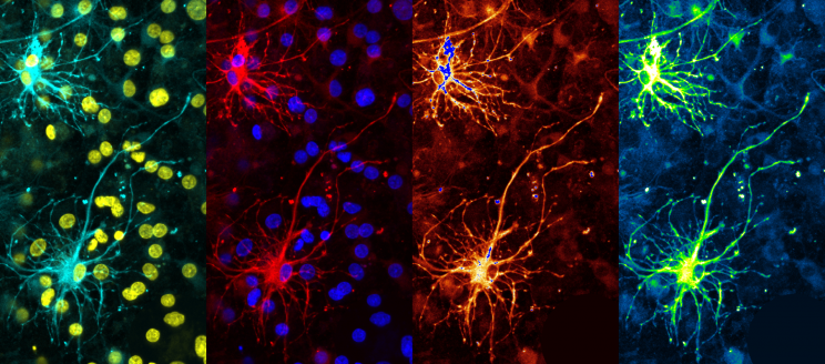 Neuralink: How the Human Brain Will Download Directly from a Computer