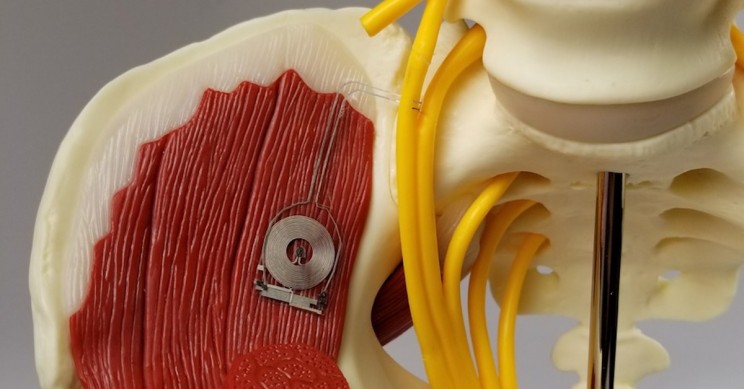 These Bioelectronic Medical Devices Disappear After Healing Damaged Nerves