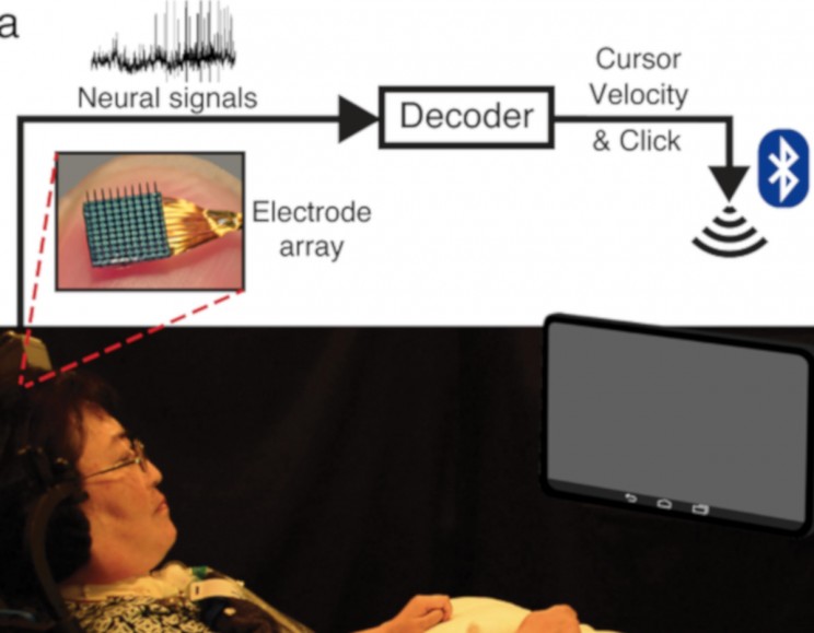 Researchers Develop Special Brain-Computer Interface System For People With Paralysis Researchers Develop Special Brain-Computer Interface System For People With Paralysis