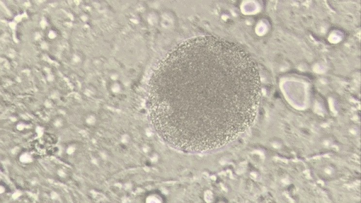 New Technology Helps Researchers Fight Deadly Malaria New Technology Helps Researchers Fight Deadly Malaria