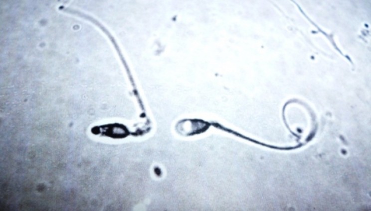 sperm in space