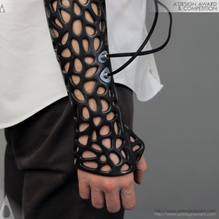 3D printed cast can heal bones 40% faster thanks to ultrasound