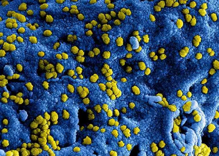 Engineered Protein Could Potentially Fight MERS Virus
