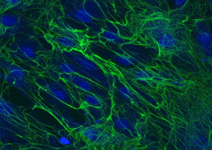 Scientists Develop Compound to Keep Scars from Forming