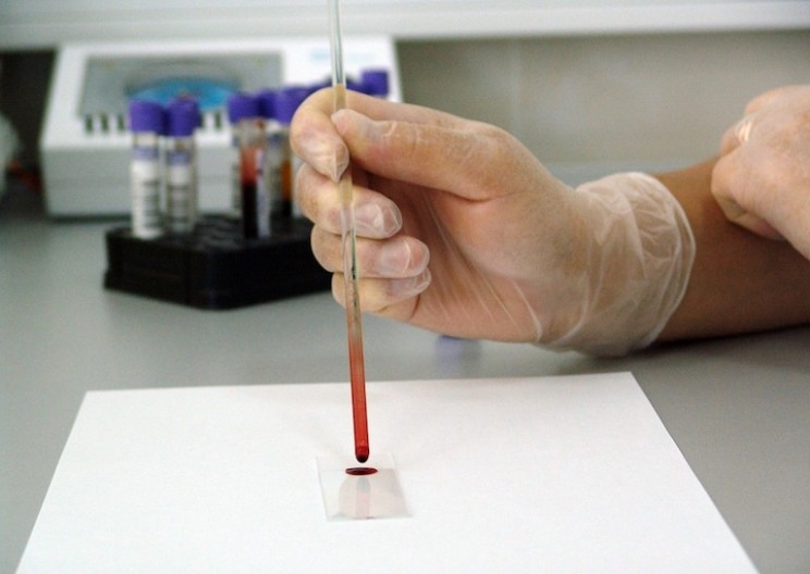 This New Test Can Screen for 13 Types of Cancer Using a Single Drop of Blood