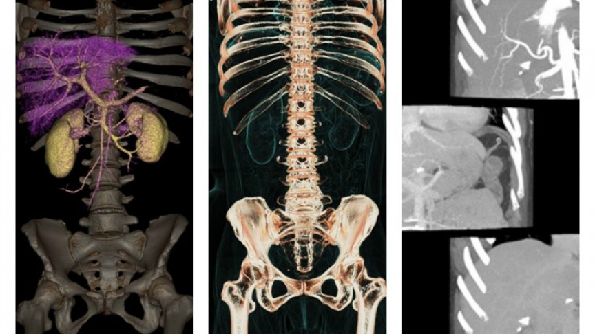 New CT Body Scanner Captures Freakishly High Definition 3D